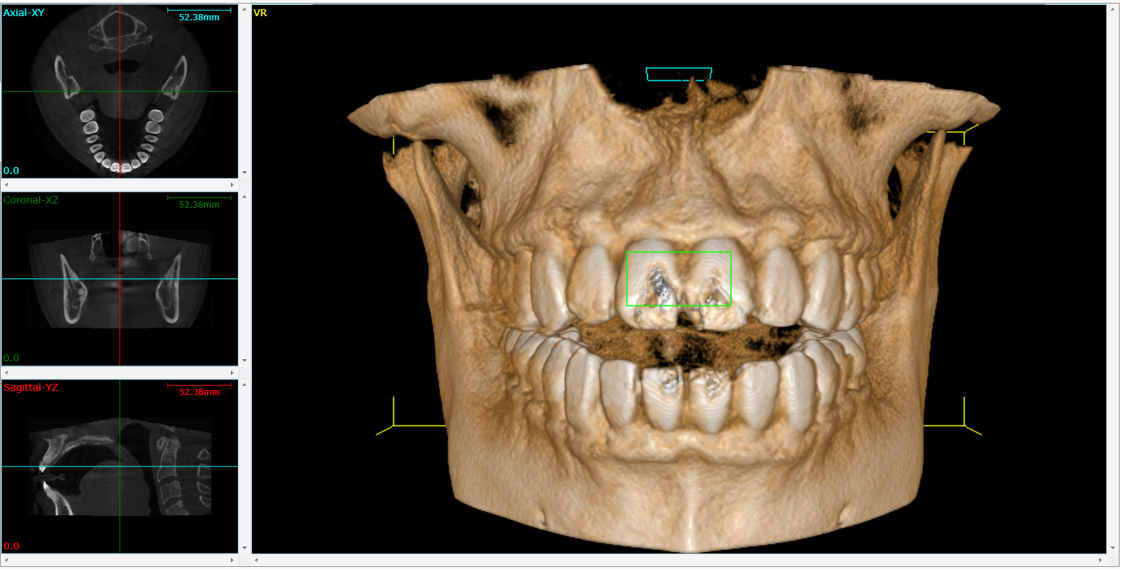 Cone Beam 3D Imaging Austin, TX