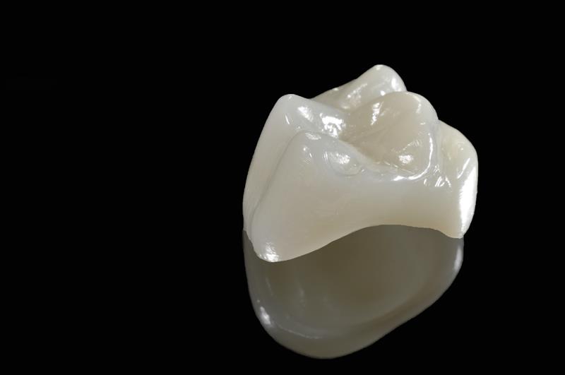 Porcelain Crowns in Austin | Shoal Creek Prosthodontic Group