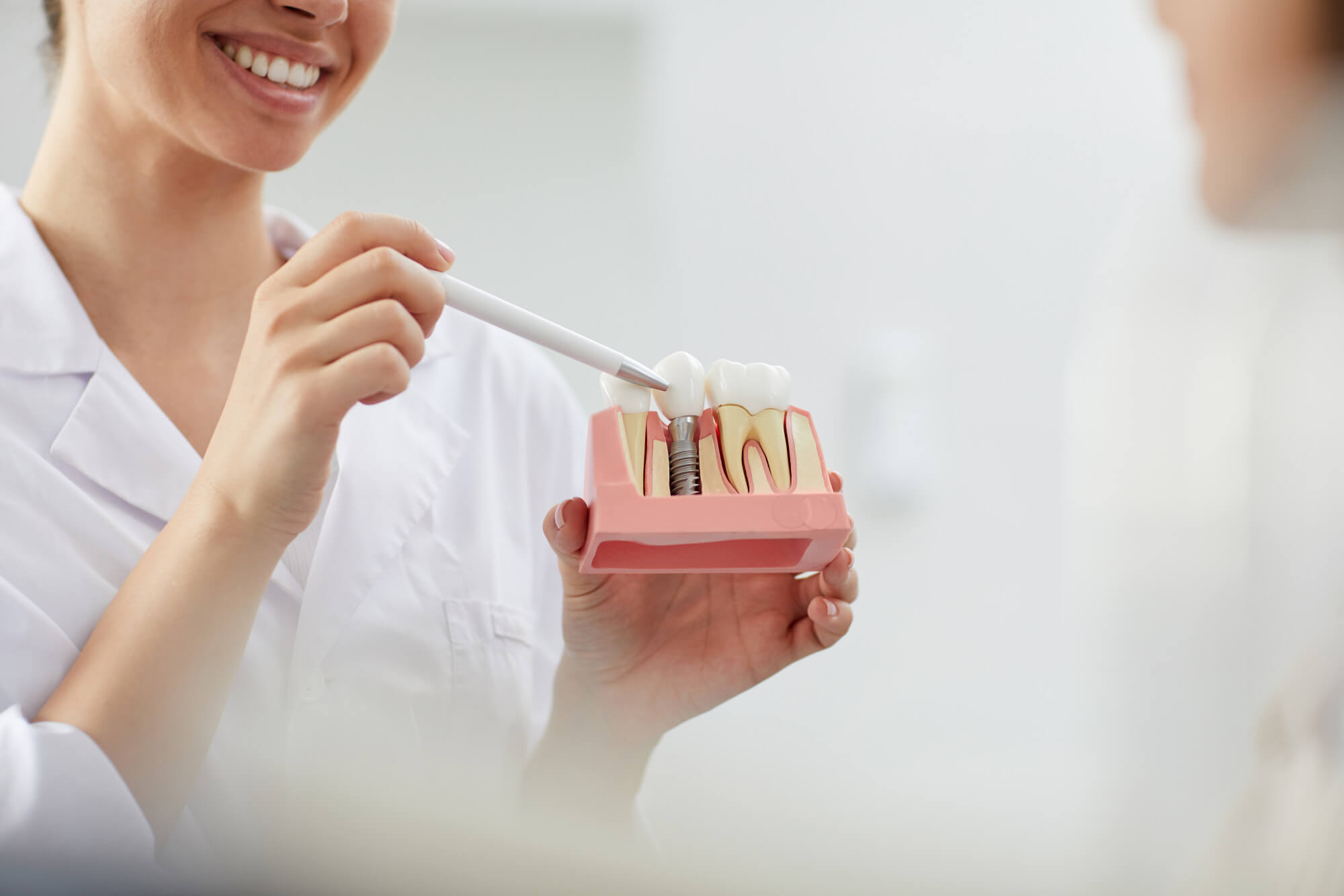 Implant Restoration image